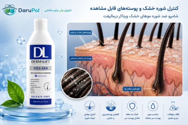 شامپو ضد شوره خشک ویتاکر درمالیفت و نمای پوست سر خشک